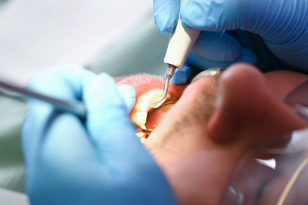 Best Urgent Care for Lost Fillings or Crowns in Coeburn, VA