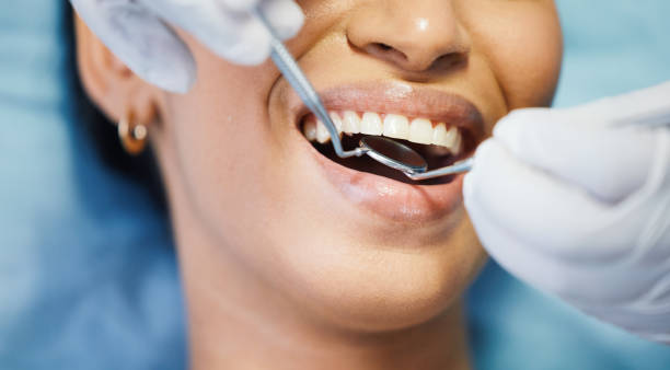 Best Same-Day Emergency Dental Services in Coeburn, VA