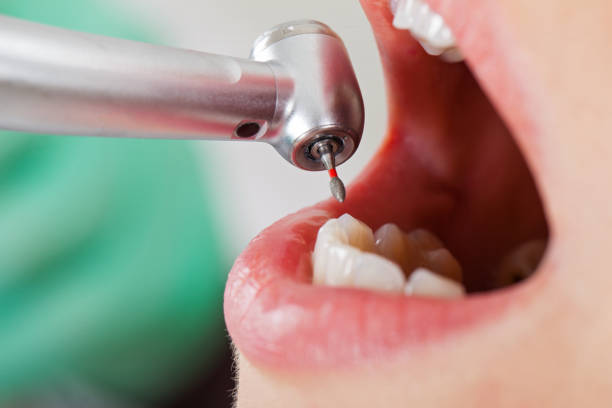 Best Pediatric Emergency Dentist in Coeburn, VA